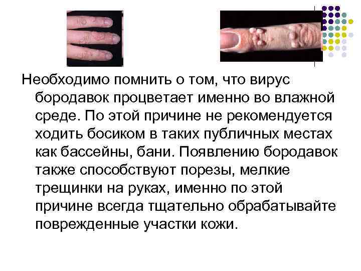 Необходимо помнить о том, что вирус бородавок процветает именно во влажной среде. По этой