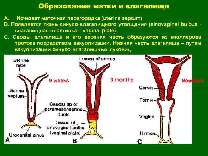 Что такое образование матки