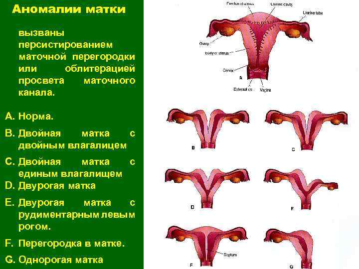 Форма матки