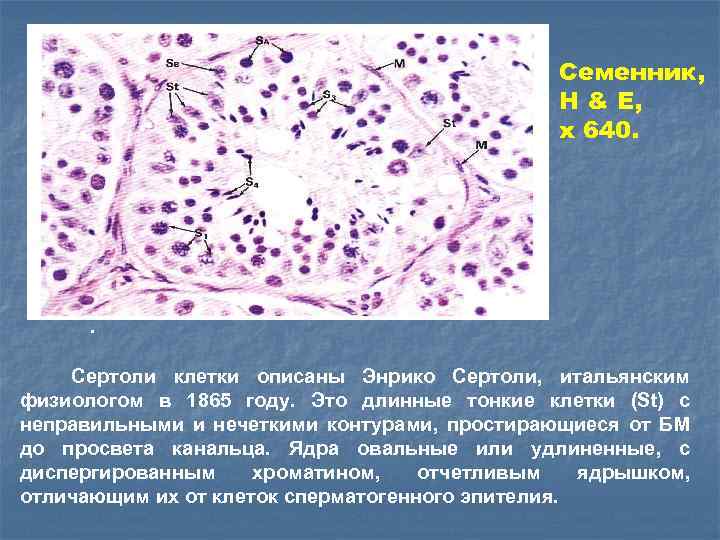 Семенник, H & E, x 640. . Сертоли клетки описаны Энрико Сертоли, итальянским физиологом