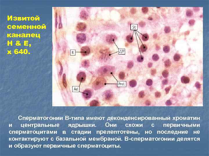 Извитой семенной каналец Н & E, x 640. Сперматогонии В-типа имеют деконденсированный хроматин и