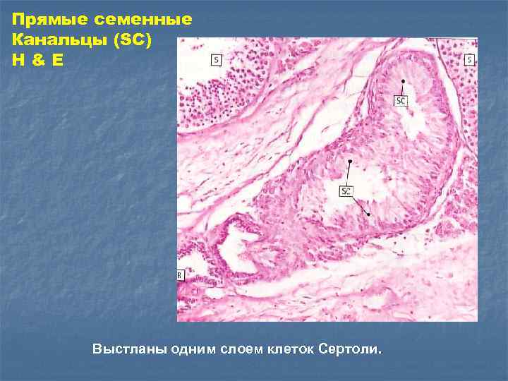 Прямые семенные Канальцы (SC) H&E Выстланы одним слоем клеток Сертоли. 