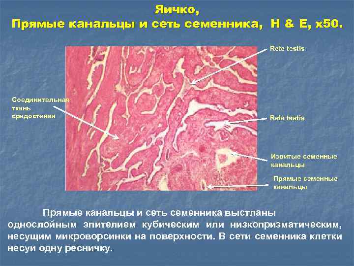 Яичко, Прямые канальцы и сеть семенника, Н & E, x 50. Rete testis Соединительная