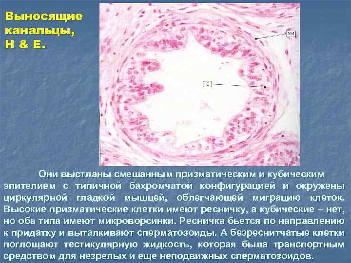 Выносящие канальцы, H & E. Они выстланы смешанным призматическим и кубическим эпителием с типичной