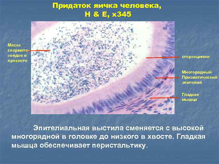 Придаток яичка человека, H & E, x 345 Масса сперматозоидов в просвете стереоцилии Многорядный