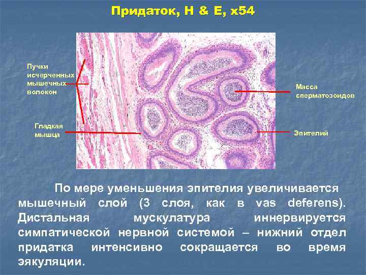 Придаток, H & E, x 54 Пучки исчерченных мышечных волокон Гладкая мышца Масса сперматозоидов