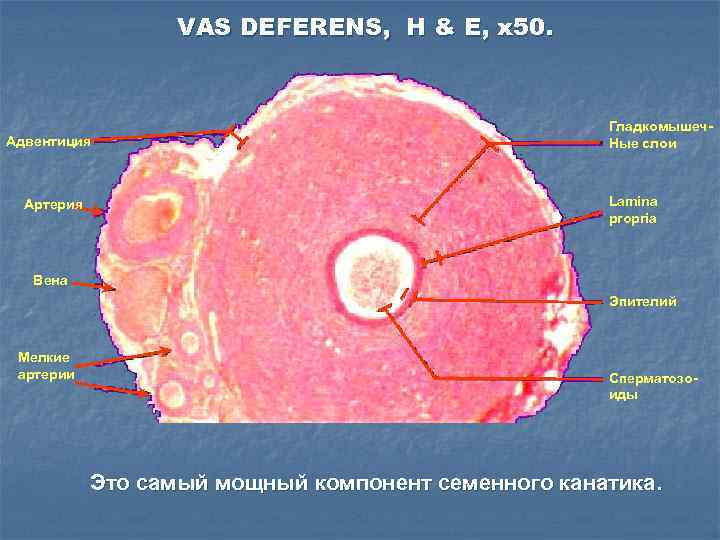 VAS DEFERENS, H & E, x 50. Адвентиция Артерия Гладкомышеч. Ные слои Lamina propria