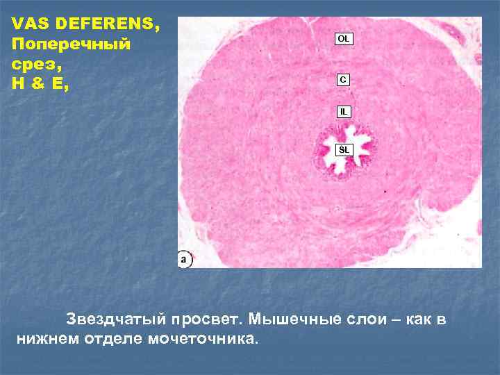 VAS DEFERENS, Поперечный срез, H & E, OL C IL SL Звездчатый просвет. Мышечные