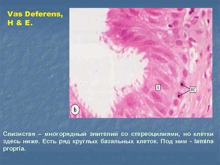 Vas Deferens, H & E. Слизистая – многорядный эпителий со стереоцилиями, но клетки здесь