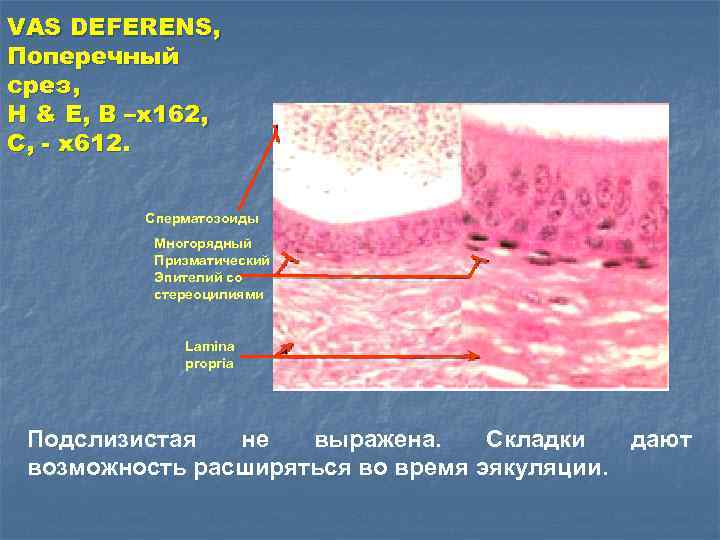 VAS DEFERENS, Поперечный срез, H & E, B –x 162, C, - x 612.