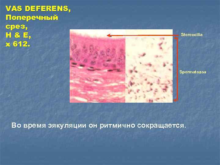 VAS DEFERENS, Поперечный срез, H & E, x 612. Stereocilia Spermatozoa Во время эякуляции