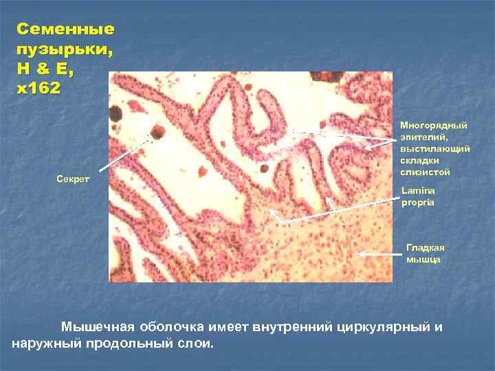 Семенные пузырьки, H & E, x 162 Секрет Многорядный эпителий, выстилающий складки слизистой Lamina