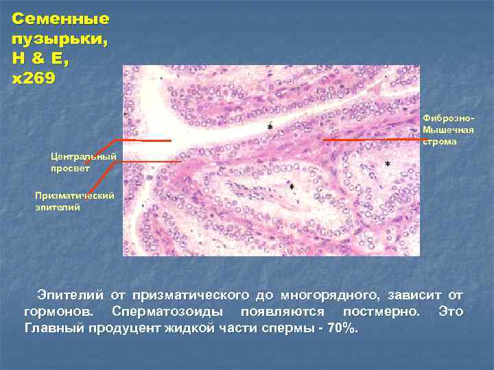 Семенные пузырьки, H & E, x 269 Фиброзно. Мышечная строма Центральный просвет Призматический эпителий