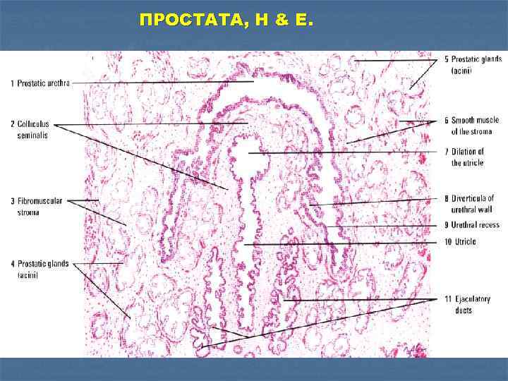 ПРОСТАТА, H & E. 