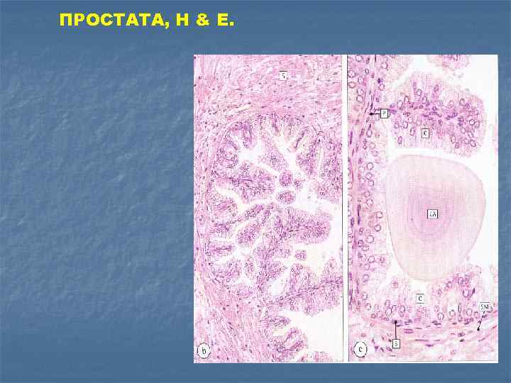 ПРОСТАТА, H & E. 