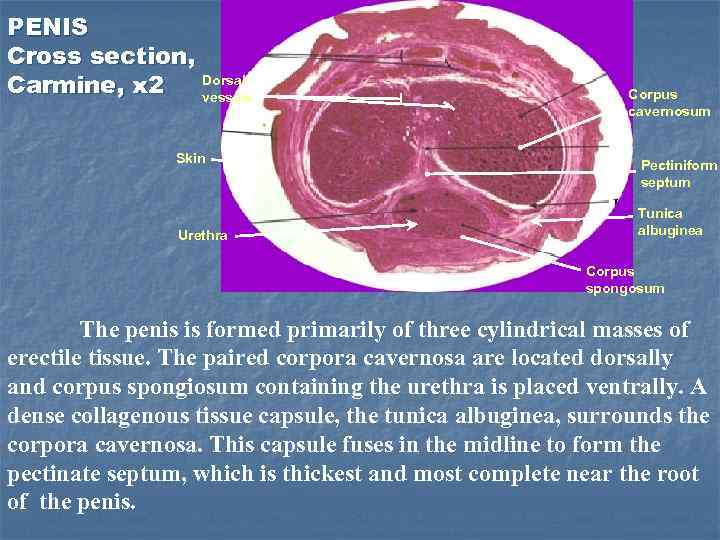 PENIS Cross section, Dorsal Carmine, x 2 vesseis Skin Urethra Corpus cavernosum Pectiniform septum