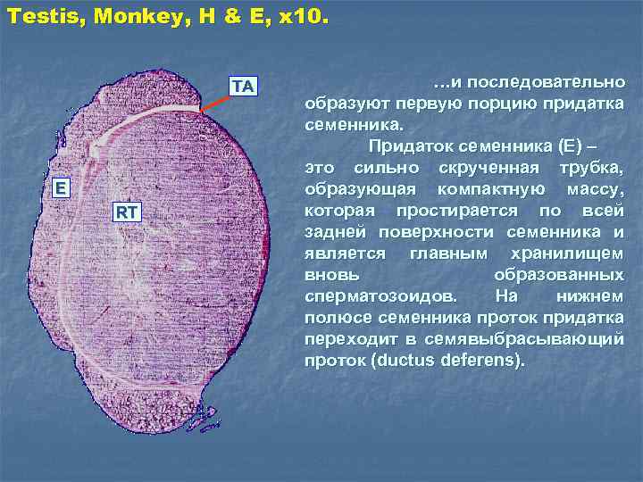 Testis, Monkey, H & E, x 10. TA E RT …и последовательно образуют первую