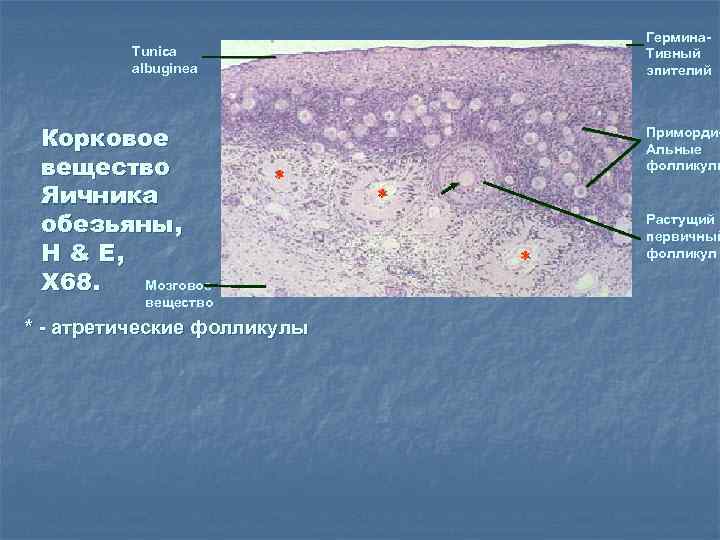Гермина. Тивный эпителий Tunica albuginea Корковое вещество Яичника обезьяны, H & E, X 68.