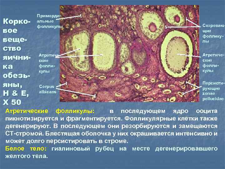Корковое вещество яичника обезьяны, H & E, X 50 Примордиальные фолликулы Созревающие фолликулы Атретические