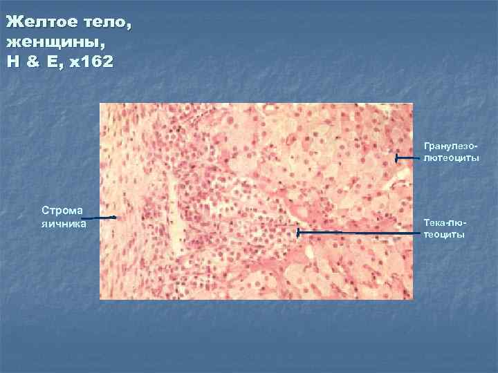 Желтое тело, женщины, H & E, x 162 Гранулезолютеоциты Строма яичника Тека-лютеоциты 