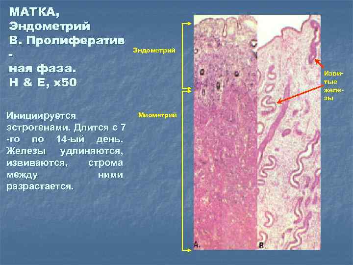 МАТКА, Эндометрий B. Пролифератив ная фаза. H & E, x 50 Инициируется эстрогенами. Длится
