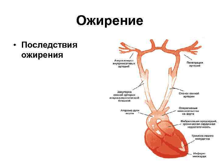 Ожирение • Последствия ожирения 