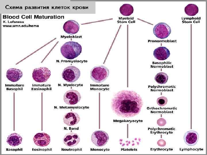 Волосатоклеточный лейкоз картина крови