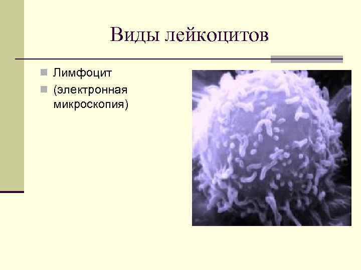 Виды лейкоцитов n Лимфоцит n (электронная микроскопия) 