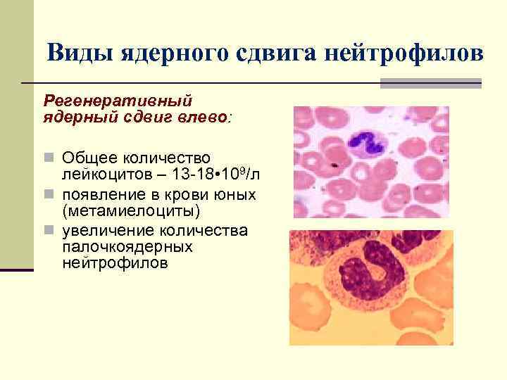 Палочкоядерные нейтрофилы 0 у женщины