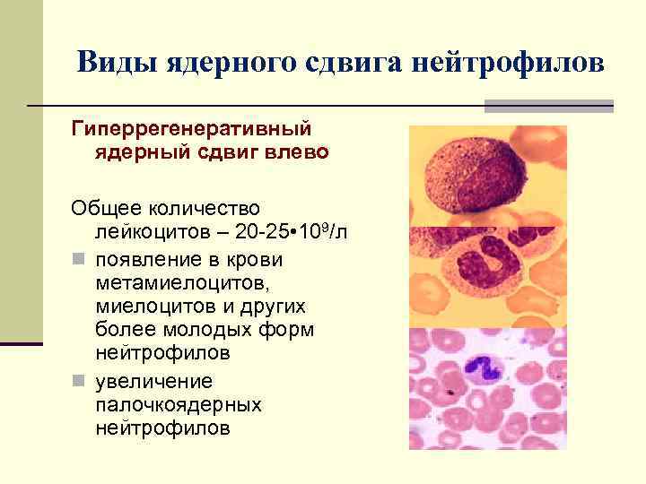 Палочкоядерные нейтрофилы у собак