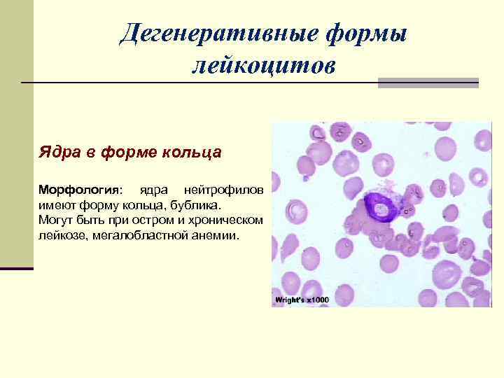 Величина лейкоцитов человека