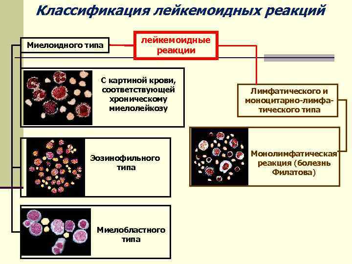 При хроническом моноцитарном лейкозе в картине крови характерен тест