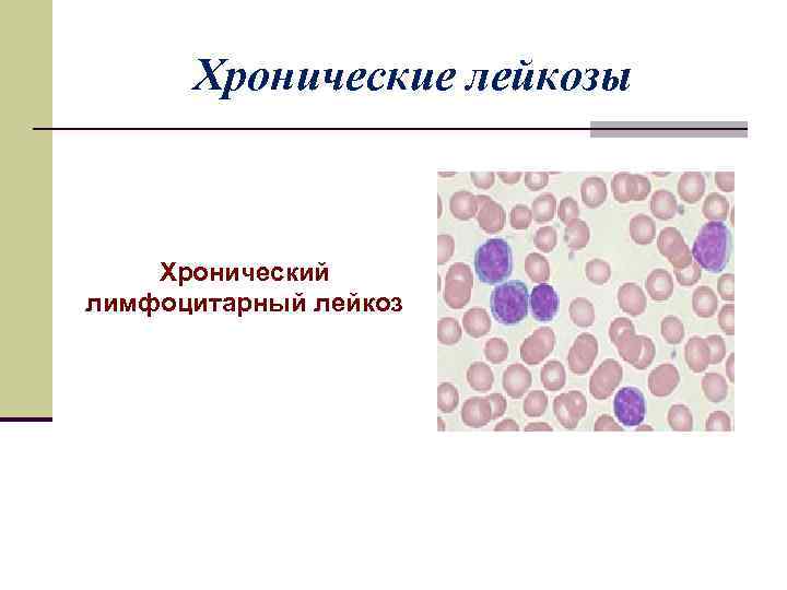 Лейкоцитарный лейкоцитоз