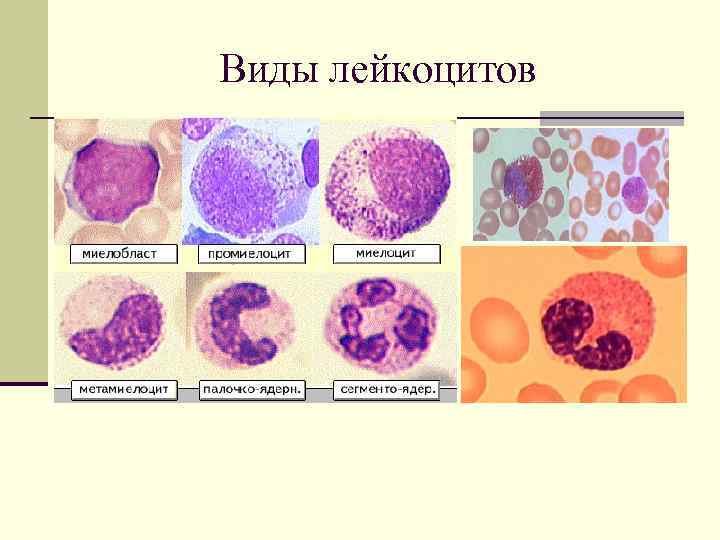 Виды лейкоцитов