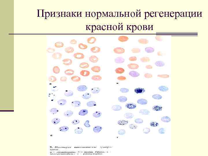 Признаки нормальной. Регенерация крови. Репаративная регенерация крови. Клетки физиологической регенерации эритроцитов. Физиологическая регенерация клеток крови.