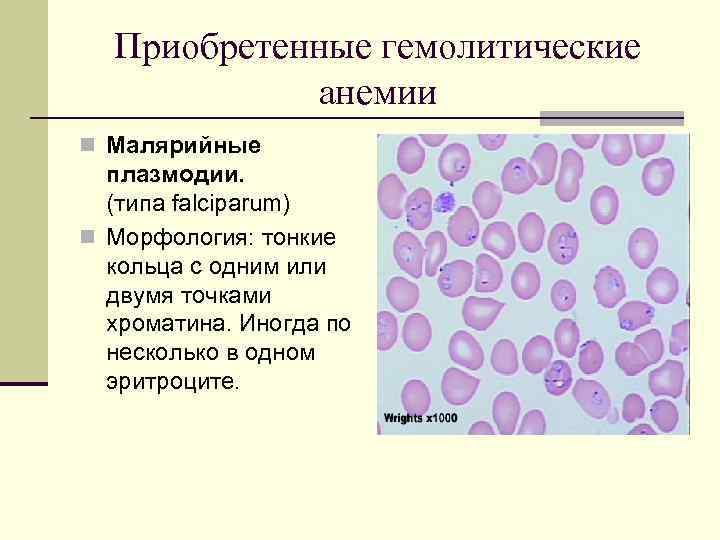 Приобретенные гемолитические анемии n Малярийные плазмодии. (типа falciparum) n Морфология: тонкие кольца с одним