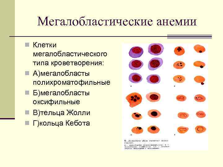 Кольца кебота в эритроцитах