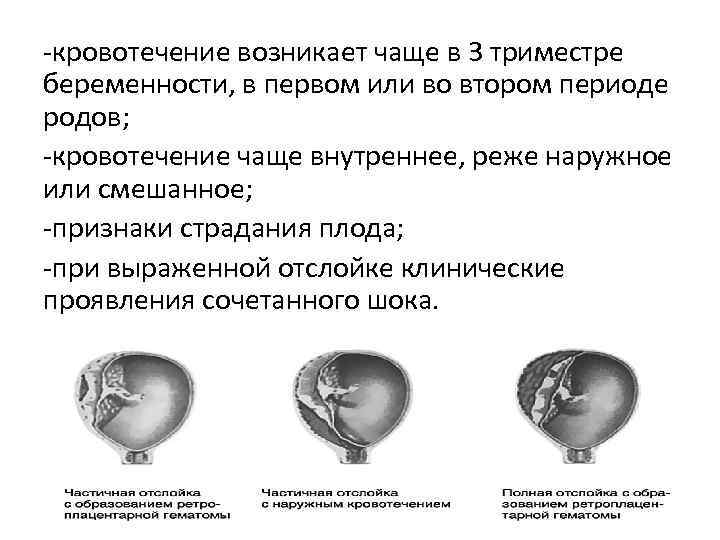 -кровотечение возникает чаще в 3 триместре беременности, в первом или во втором периоде родов;