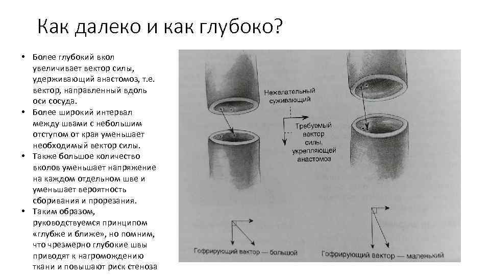 Сосудистый шов презентация