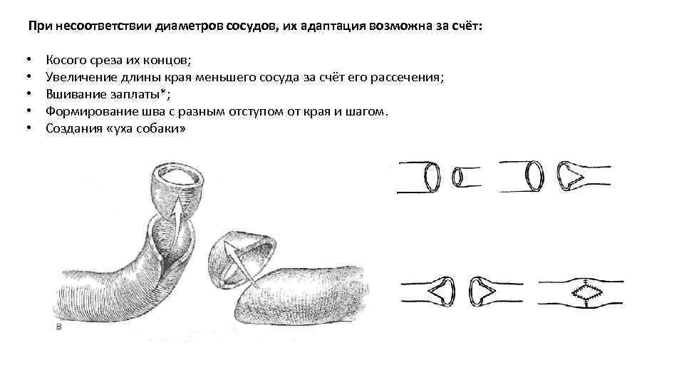 Сосудистый шов презентация