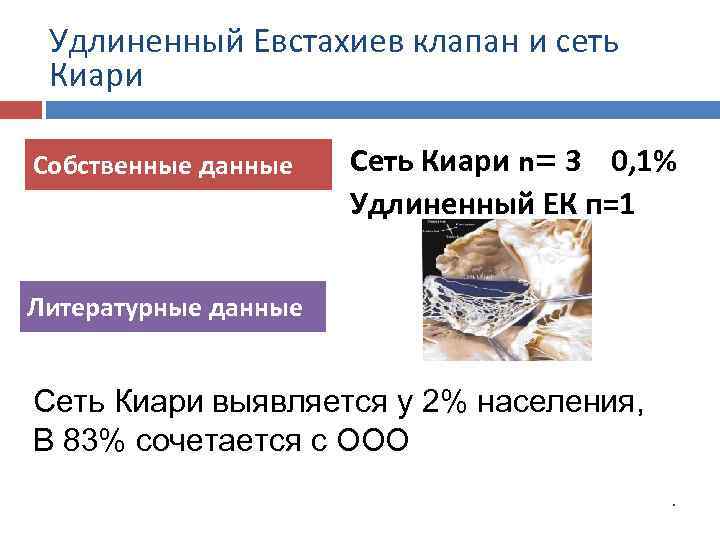 Удлиненный Евстахиев клапан и сеть Киари Собственные данные Сеть Киари n= 3 0, 1%