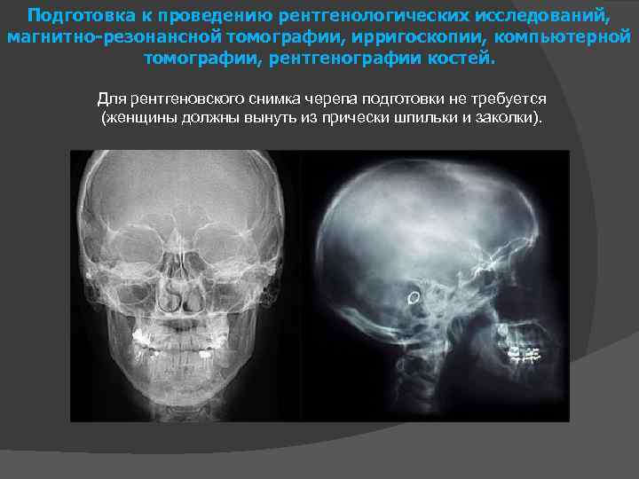 Подготовка к проведению рентгенологических исследований, магнитно-резонансной томографии, ирригоскопии, компьютерной томографии, рентгенографии костей. Для рентгеновского