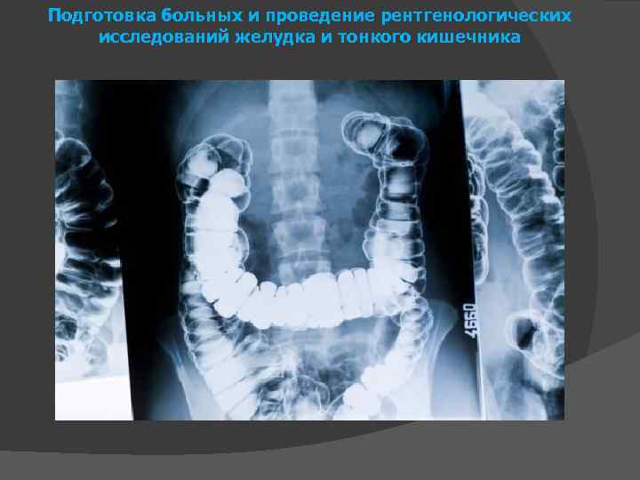 Подготовка больных и проведение рентгенологических исследований желудка и тонкого кишечника 