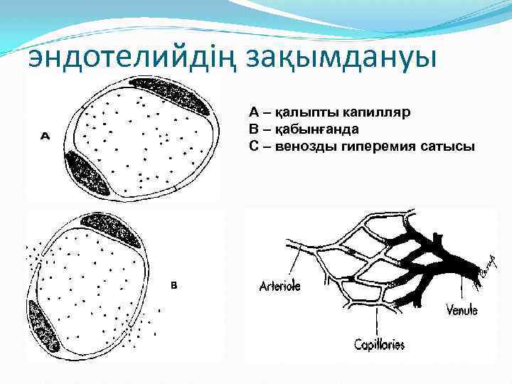 эндотелийдің зақымдануы A – қалыпты капилляр В – қабынғанда С – венозды гиперемия сатысы