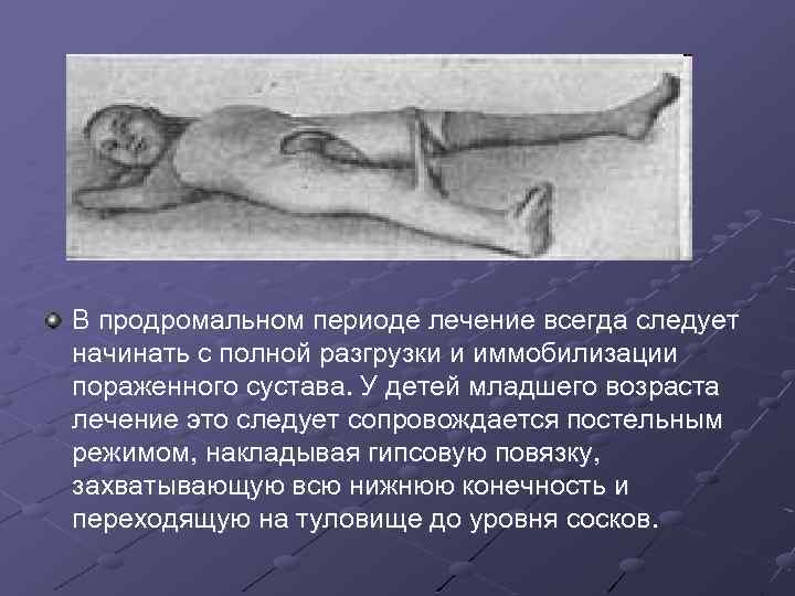 В продромальном периоде лечение всегда следует начинать с полной разгрузки и иммобилизации пораженного сустава.