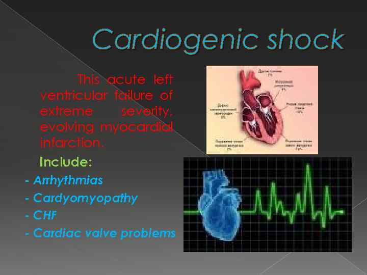 Cardiogenic shock This acute left ventricular failure of extreme severity, evolving myocardial infarction. Include: