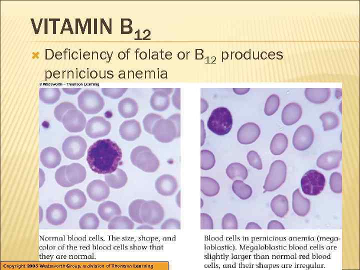 VITAMIN B 12 Deficiency of folate or B 12 produces pernicious anemia Copyright 2005