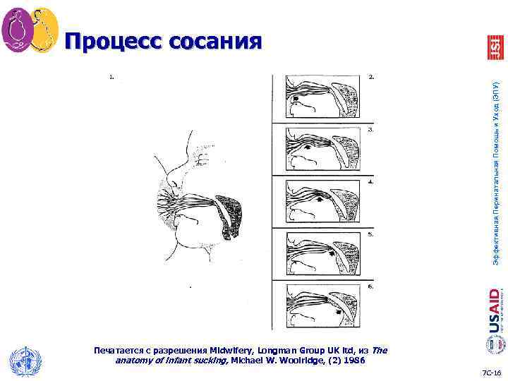 Эффективная Перинатальная Помощь и Уход (ЭПУ) Процесс сосания Печатается с разрешения Midwifery, Longman Group