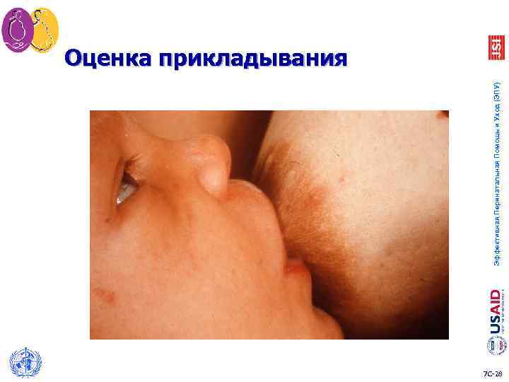 Эффективная Перинатальная Помощь и Уход (ЭПУ) Оценка прикладывания 7 C-28 