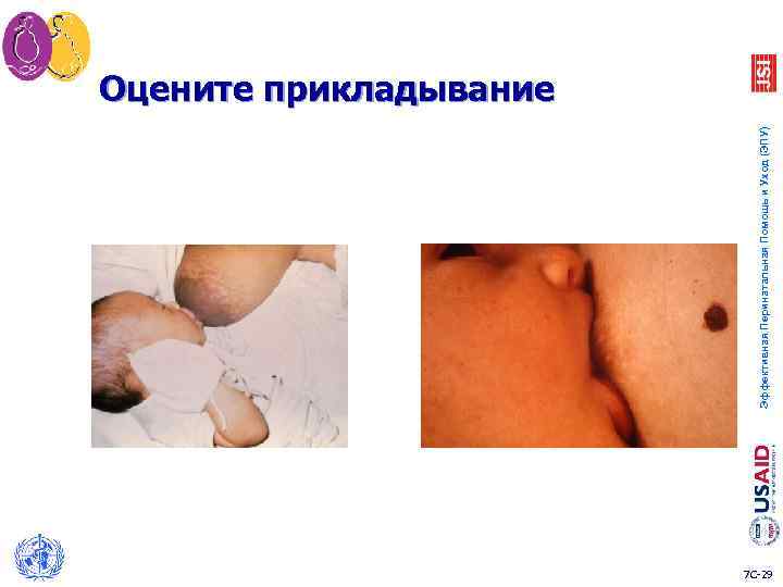 Эффективная Перинатальная Помощь и Уход (ЭПУ) Оцените прикладывание 7 C-29 